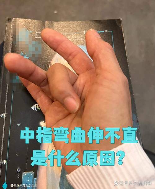 手指彎曲無自主能力