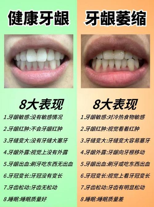 牙齒看出你的富貴與長壽