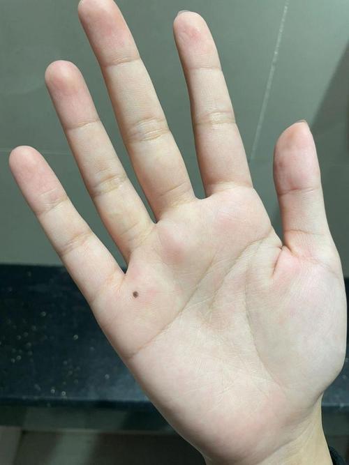 女孩左手掌有痣好不好