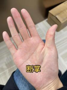 女人左手?jǐn)嗾茣?huì)怎么樣