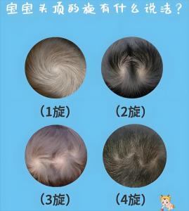 發旋在后腦勺的人命運