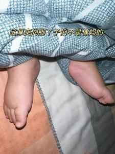 腳厚的人有福氣嗎