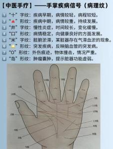 健康線意味著什么 健康線出現代表有大病嗎