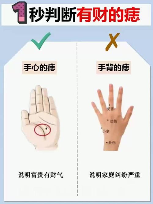 男人手掌心長痣好不好 命運怎么樣