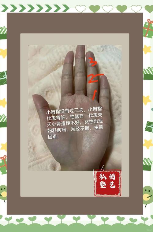 小拇指內彎的人命不好 有什么說法
