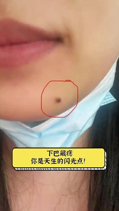 下巴底下藏著的痣好嗎?