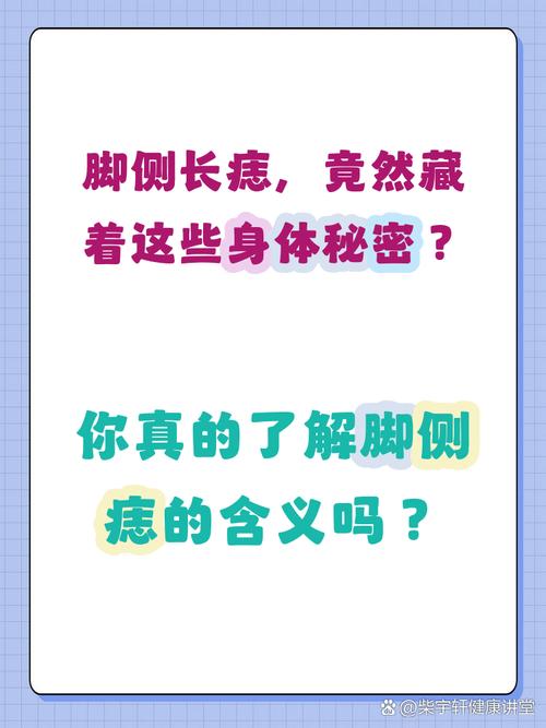 腳側(cè)面長痣代表什么