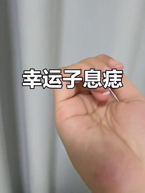 右手小拇指有痣