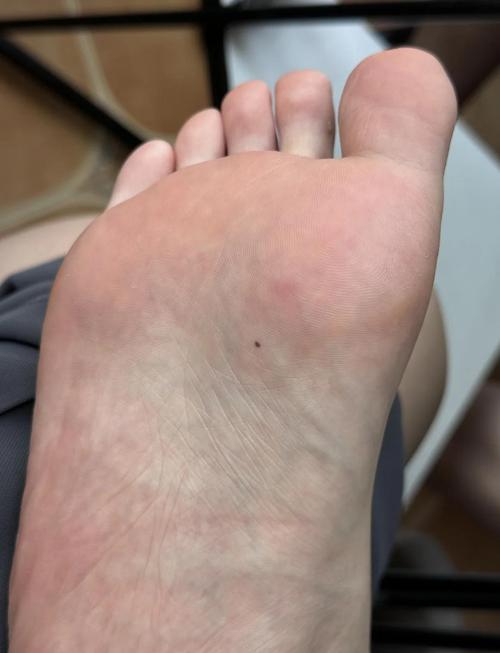 右腳心有痣的男人
