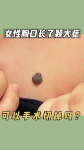 右胸下方有痣好嗎女的