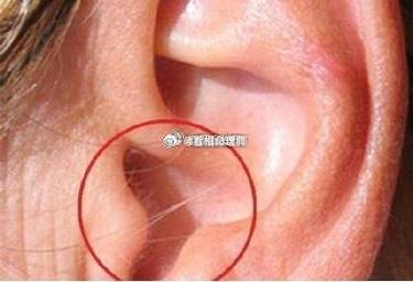 耳洞口長毛富貴命,耳屏長毛運勢?