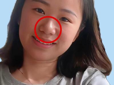 懸膽鼻長什么樣？懸膽鼻標(biāo)準(zhǔn)照片