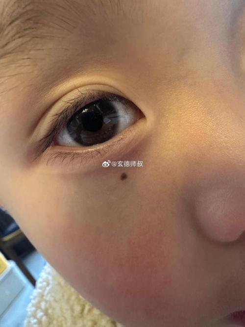 若你有淚痣他有苦情痣，請(qǐng)務(wù)必相守一輩子