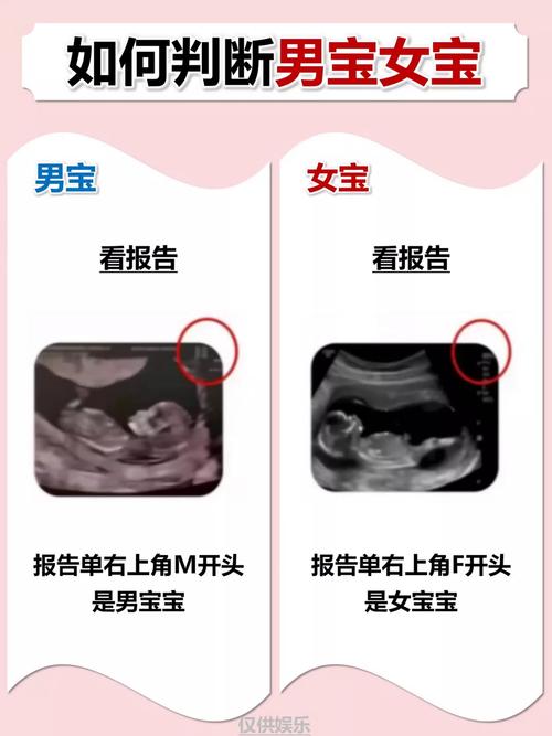 相學教你如何辨別胎兒性別