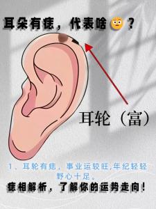 耳朵長痣，看出你一生運勢