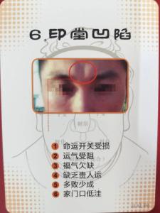 印堂凹陷的男人面相分析