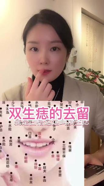 雙生痣點(diǎn)掉了會(huì)怎樣
