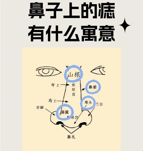 鼻子右邊有痣好嗎