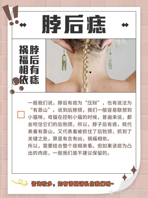脖子后有痣的女人有富貴命嗎