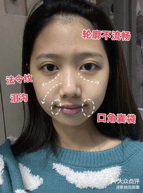 法令紋深的人報復心很強是真的嗎