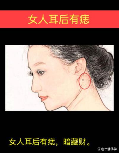 女人耳背有痣好嗎