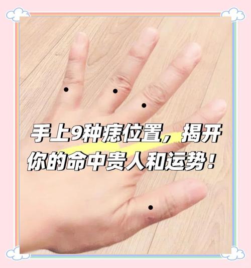 痣說(shuō)人生：手背痣的位置與命運(yùn)