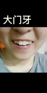 門牙大的人有財嗎