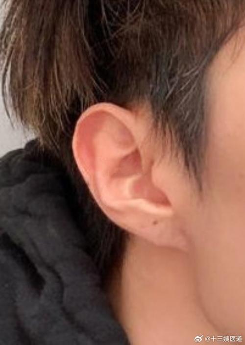 面相看男的耳朵薄好不好