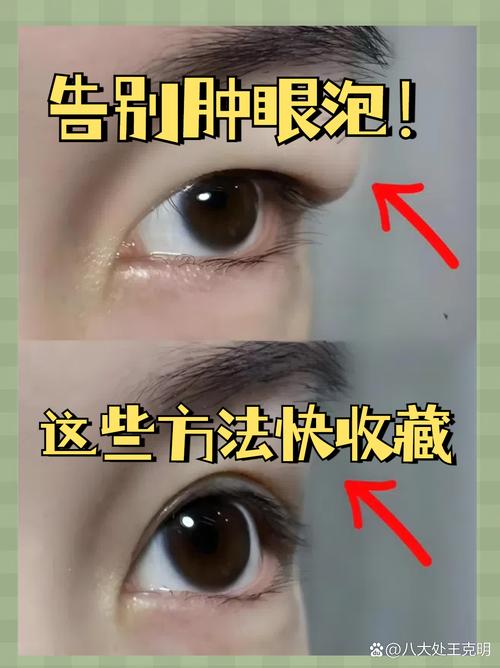 治療金魚眼