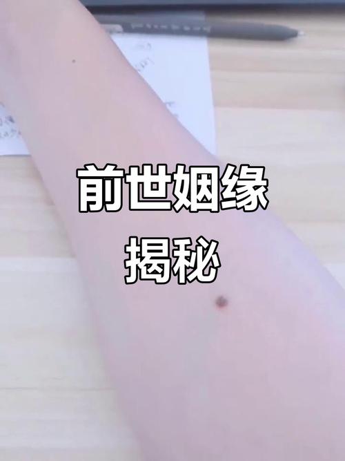 手臂上有哪種痣，會讓你的婚姻美滿