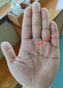 手掌雜紋看命運——十字紋