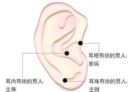 男人耳朵有痣是好是壞