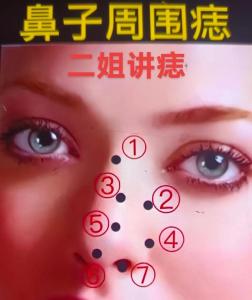 看相面部痣鼻子兩邊有痣
