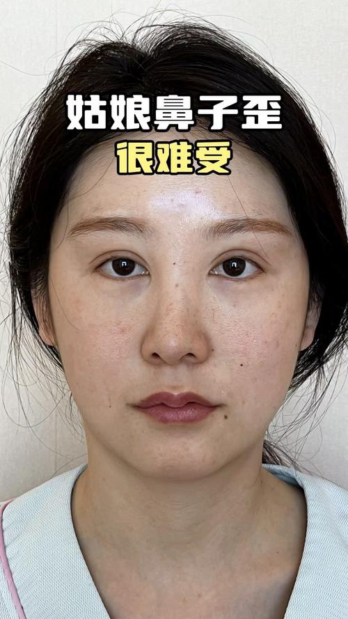 沒福氣的女人面相 鼻梁歪斜鼻孔朝天