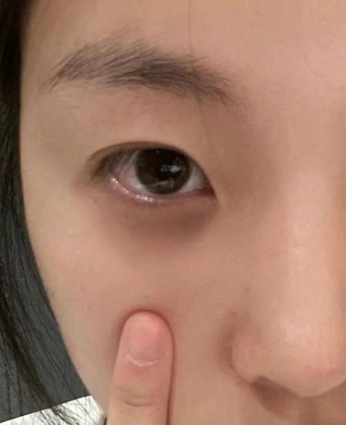 女孩眼周圍破相命好