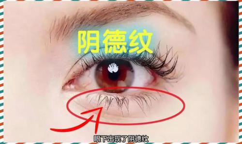 女人陰騭紋長(zhǎng)什么樣子