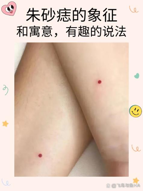 朱砂痣是不是處女痣