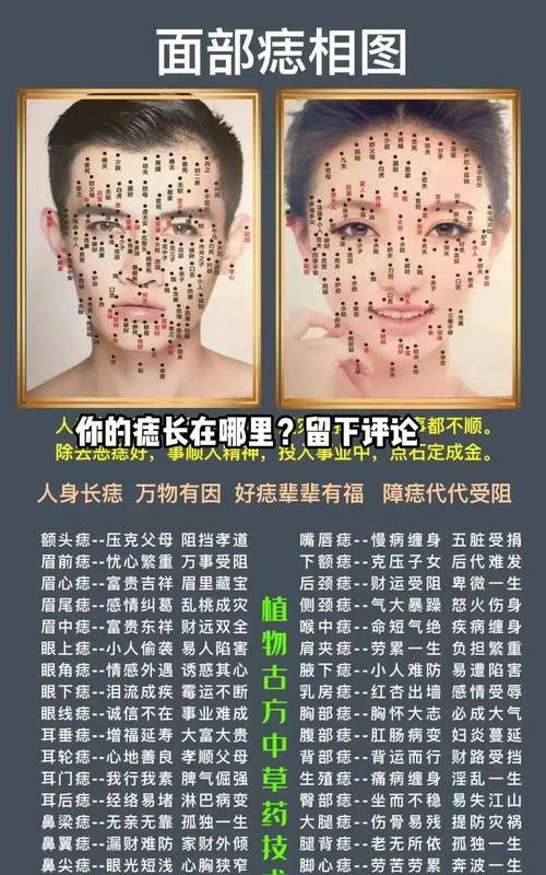女性面部長這些痣容易破財(cái)