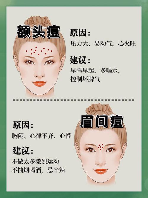 痘痘位置預示哪些問題