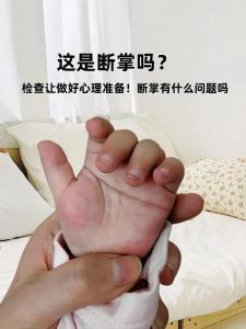 小寶寶斷掌有講究嗎 代表什么