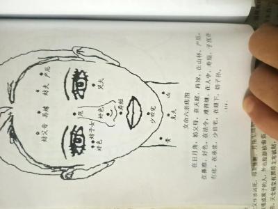 山根有痣是好還是不好