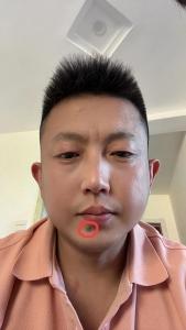 男人下巴有痣到底好不好