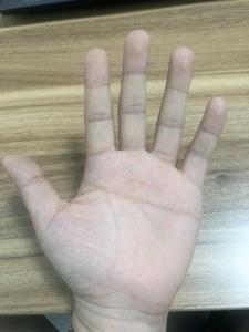 兩只手都是斷掌紋的男人財運好不好