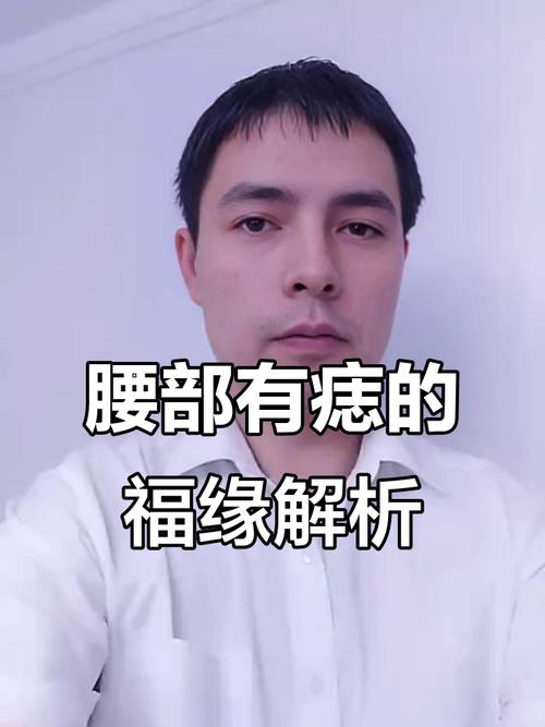 腰上有痣的男人有錢嗎 腰上有痣財(cái)運(yùn)好嗎
