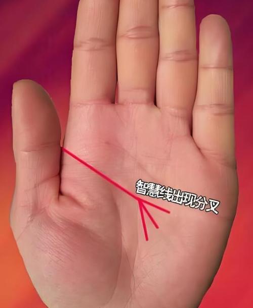 智慧線分叉三條 財運好 以后會出名