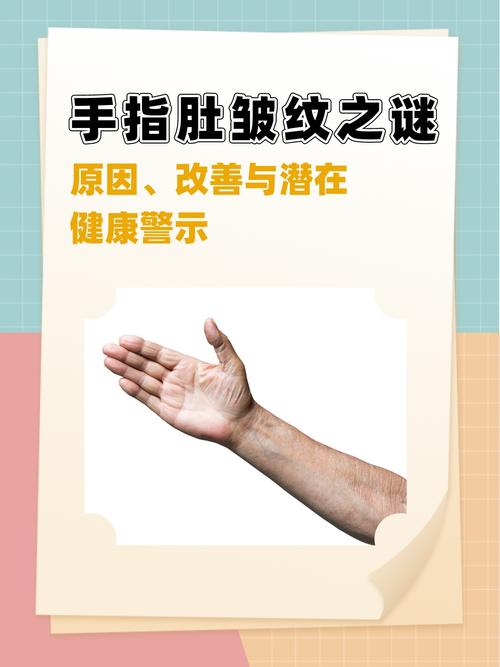 指腹上有橫紋預兆 事業積極進取性增強