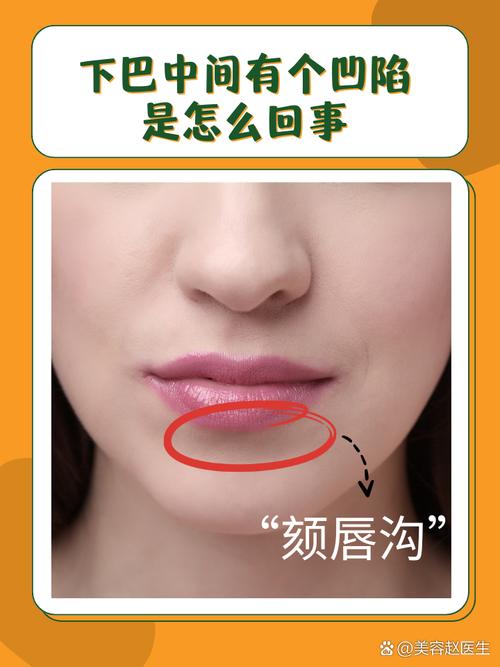 下巴中間有個窩有福嗎 下巴有溝好不好