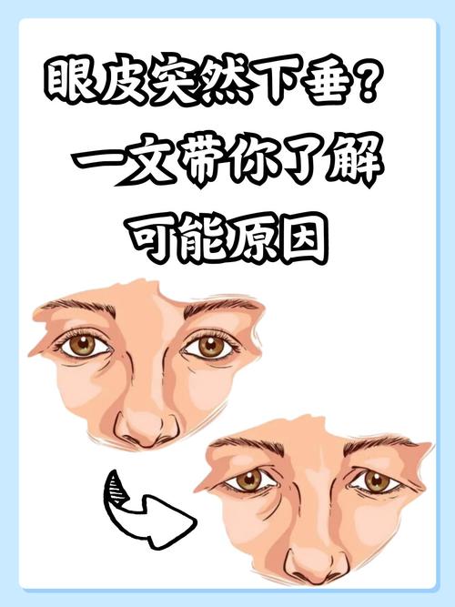 女人眼角下垂面相解析