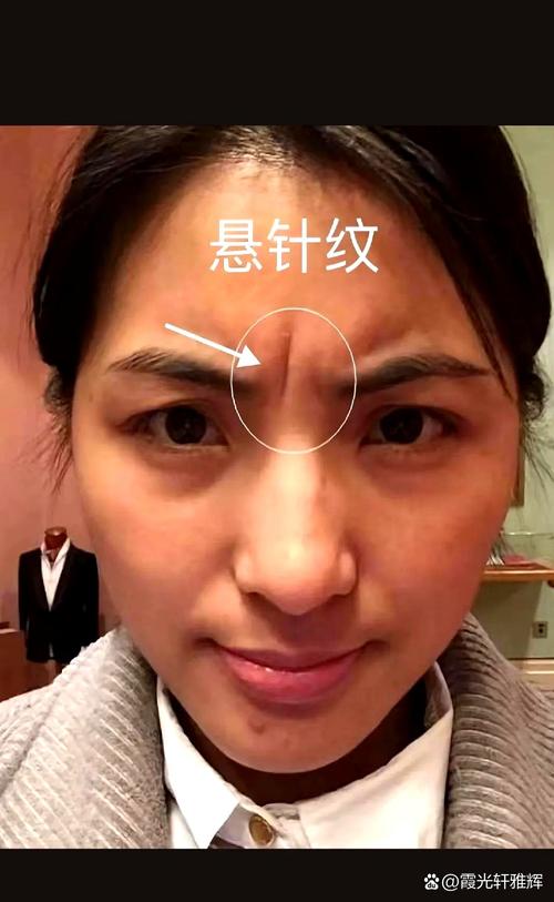 懸針紋長有額頭好嗎