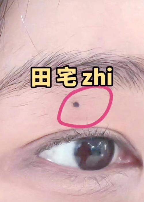 什么是田宅宮？田宅宮有痣好不好？